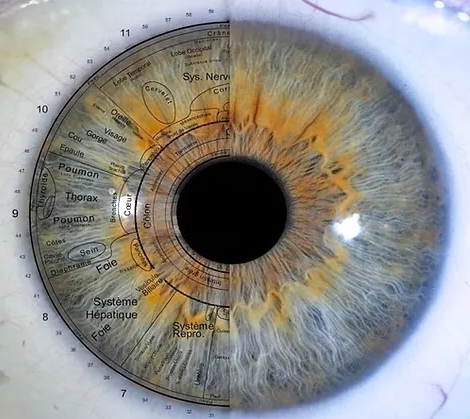 photo iridologie